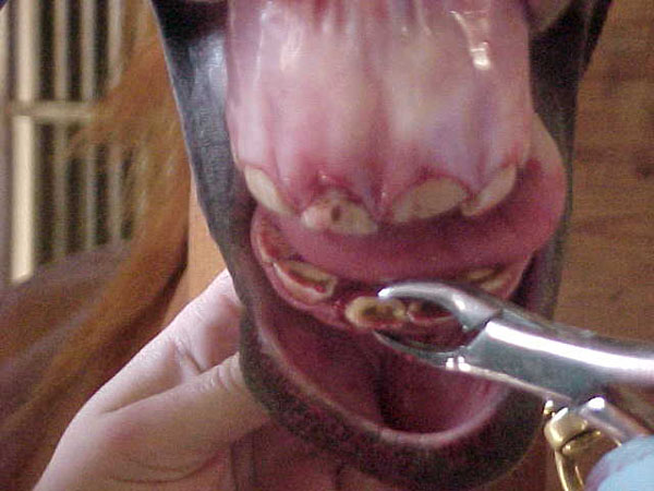extract 05incisor