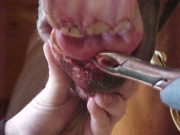 extract 06incisor