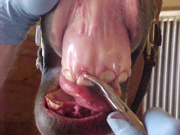 extract 07incisor
