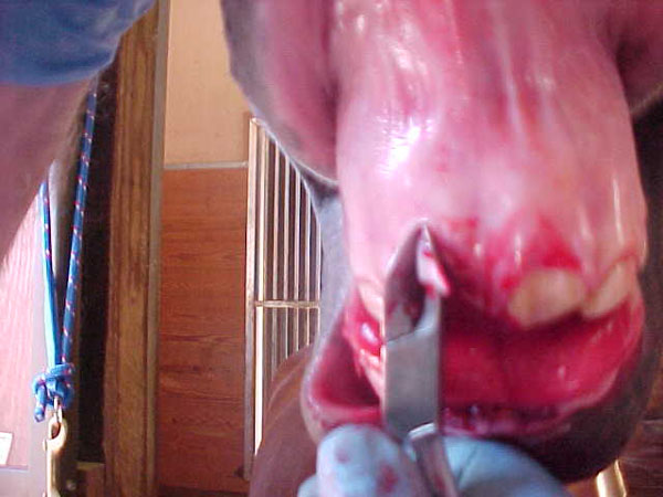 extract 11incisor