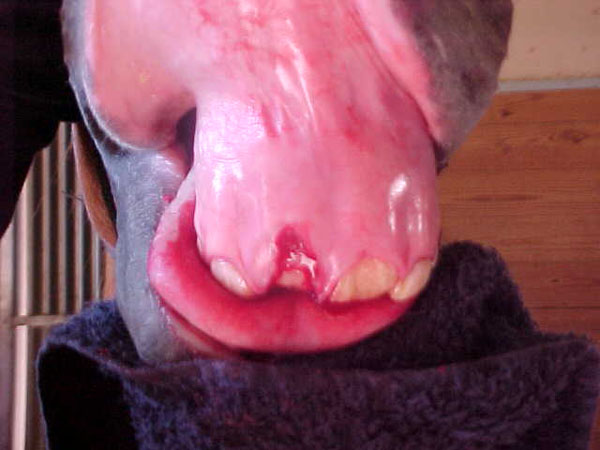 extract 12incisor